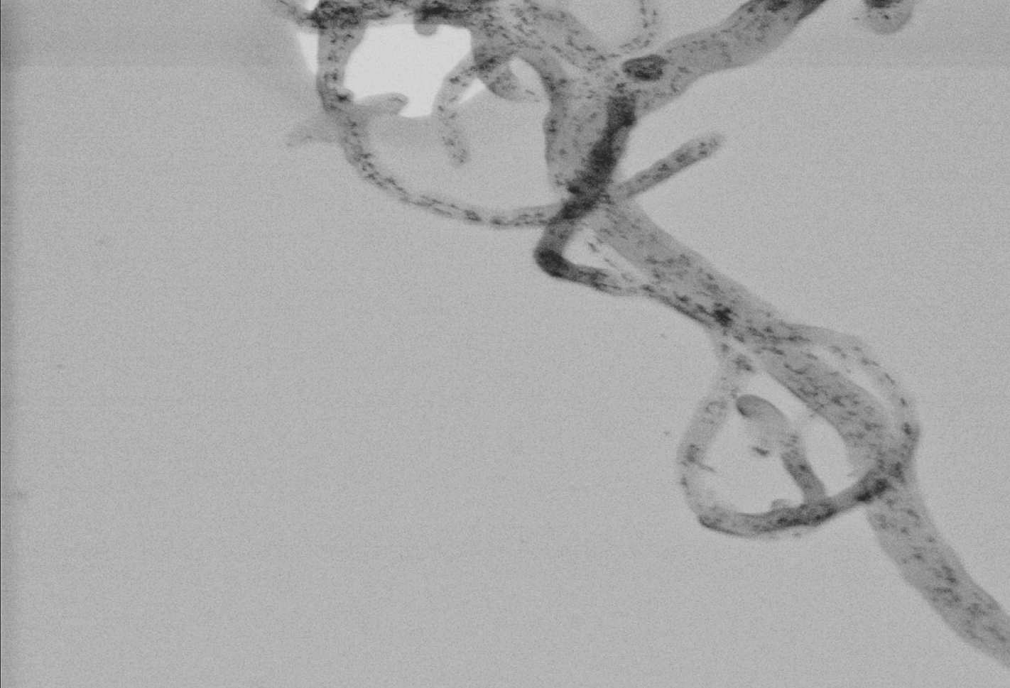 New electron detection modes in ESEM microscope