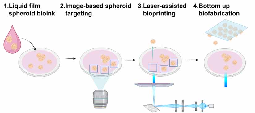 Graphical abstract of the publication entitled Laser-assisted bioprinting of targeted cartilaginous spheroids for high density bottom-up tissue engineering
