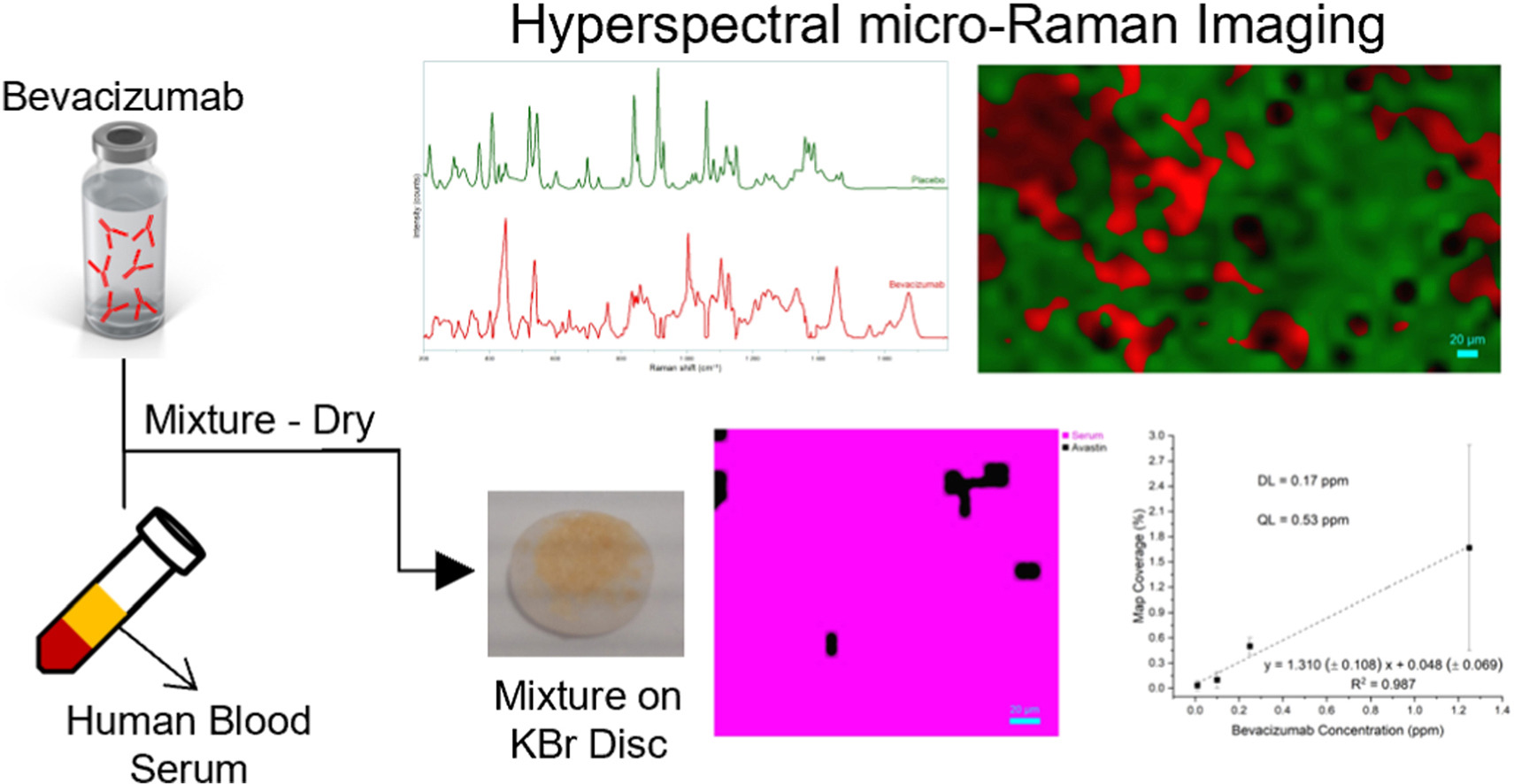 Graphical abstract of the publication entitled  Characterization and quantitation of bevacizumab in human blood serum through hyperspectral micro-Raman spectroscopy imaging   